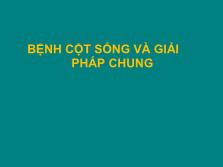 Bệnh cột sống và giải pháp chung