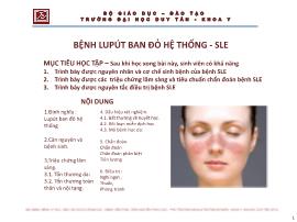 Bệnh lupút ban đỏ hệ thống - Sle