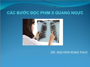 Các bước đọc phim x quang ngực