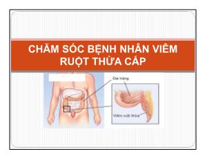 Chăm sóc bệnh nhân viêm ruột thừa cấp