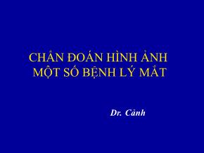 Chẩn đoán hình ảnh một số bệnh lý mắt