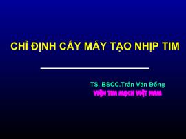 Chỉ định cấy máy tạo nhịp tim