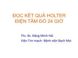 Đọc kết quả holter điện tâm đồ 24 giờ