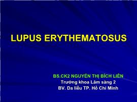 Lupus erythematosus - Nguyễn Thị Bích Liên