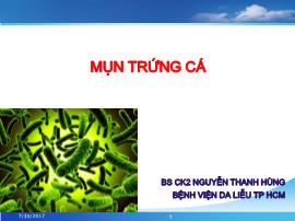 Mụn trứng cá - Nguyễn Thanh Hùng