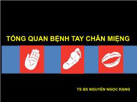 Tổng quan bệnh tay chân miệng