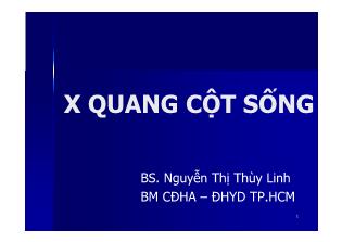 X Quang cột sống - Nguyễn Thị Thùy Linh